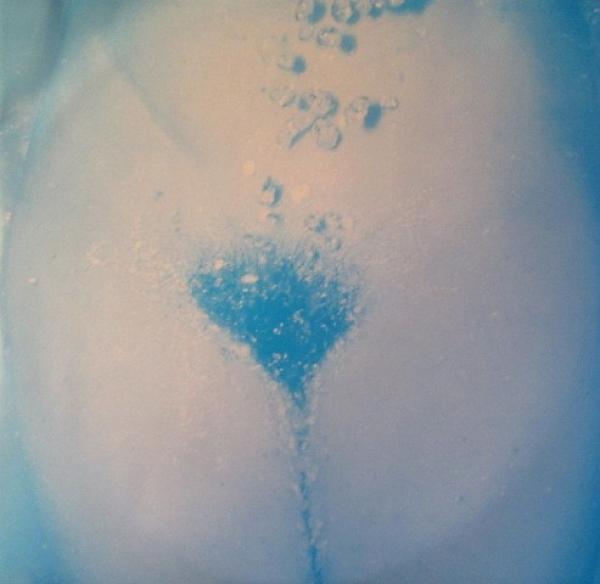 Malaria!, Wassermann, The Modernist - Kaltes Klares Wasser